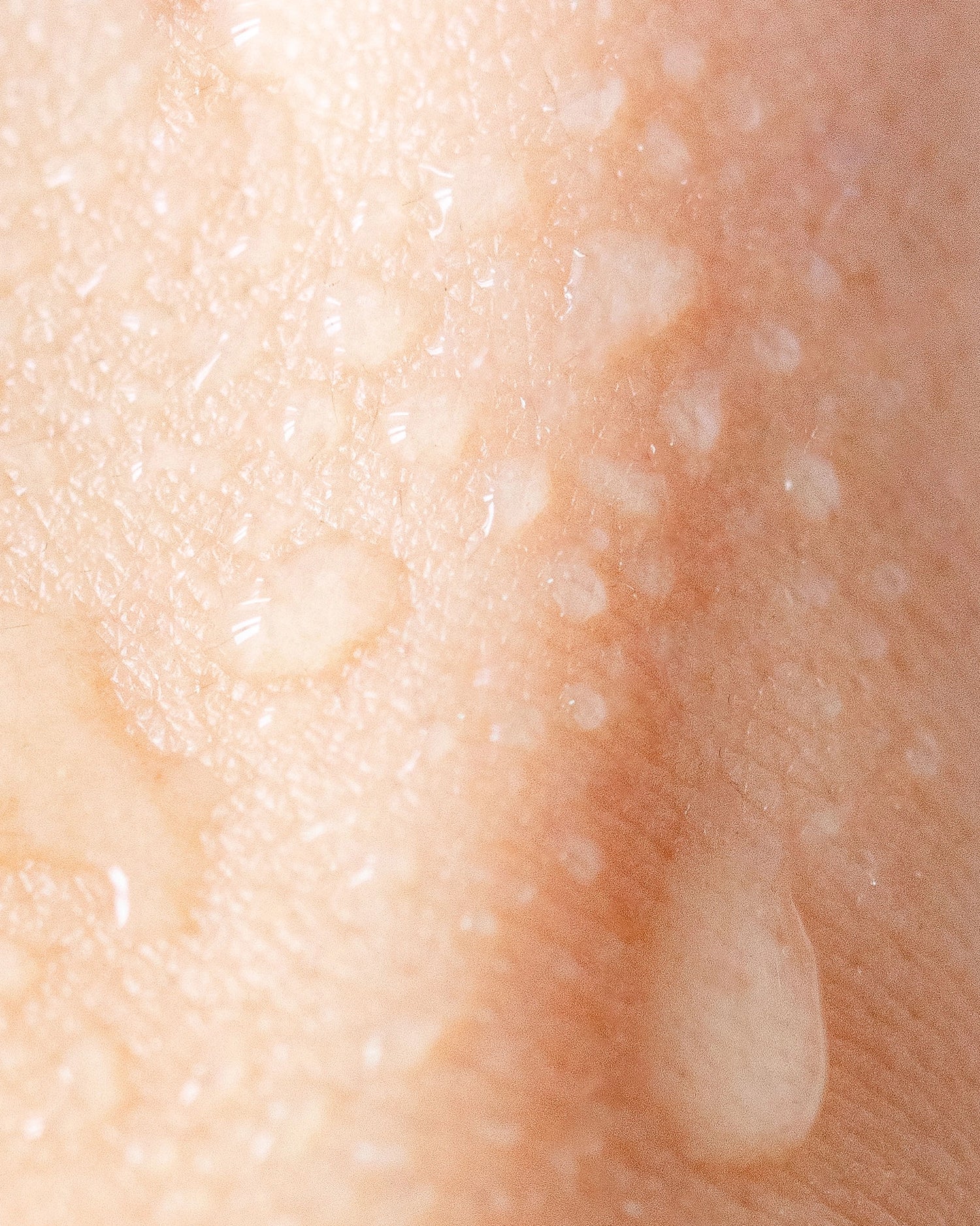 Effet hydratant de la brume Aliscential sur la peau